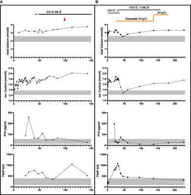 Case Report: Severe Neonatal Course in Paternally Derived Familial Hypocalciuric Hypercalcemia